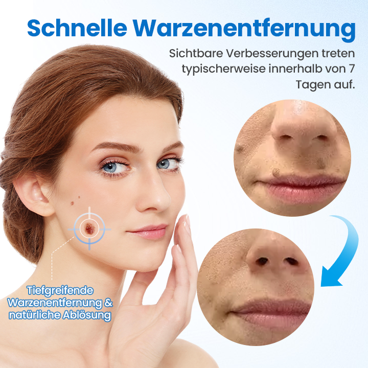 WartClear™ TagGone Warzenentfernungscreme
