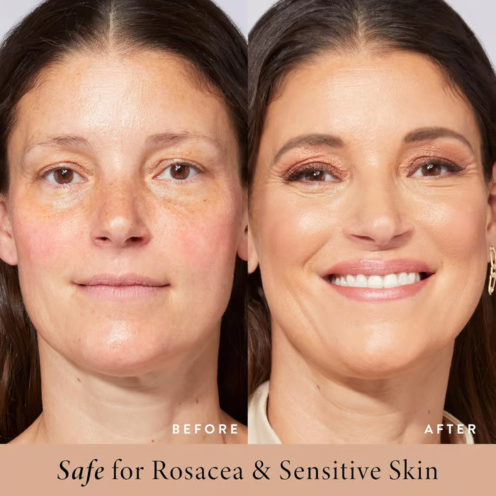 BloomSkin™ | BB-Feuchtigkeitscreme SPF 30 – Für Einen Strahlenden, Ebenmäßigen Teint
