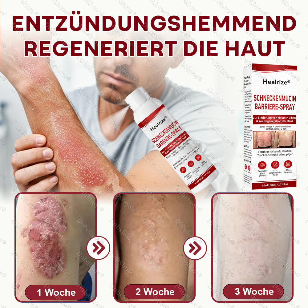 ✅🔥Healrize® Schneckenmucin-Barriere-Spray zur Linderung von Hautschüben und zur Regeneration der Haut