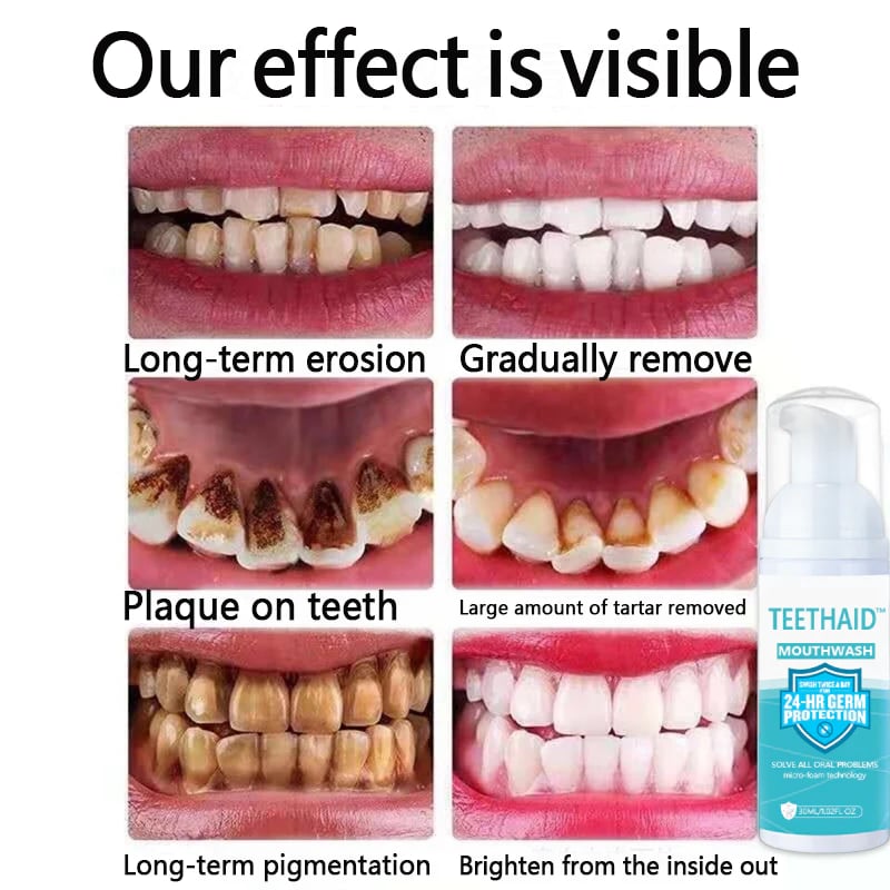 🔥 50% RABATT | BrightMint™ Premium Mundspülung – Für Frischen Atem & Strahlend Gepflegte Zähne