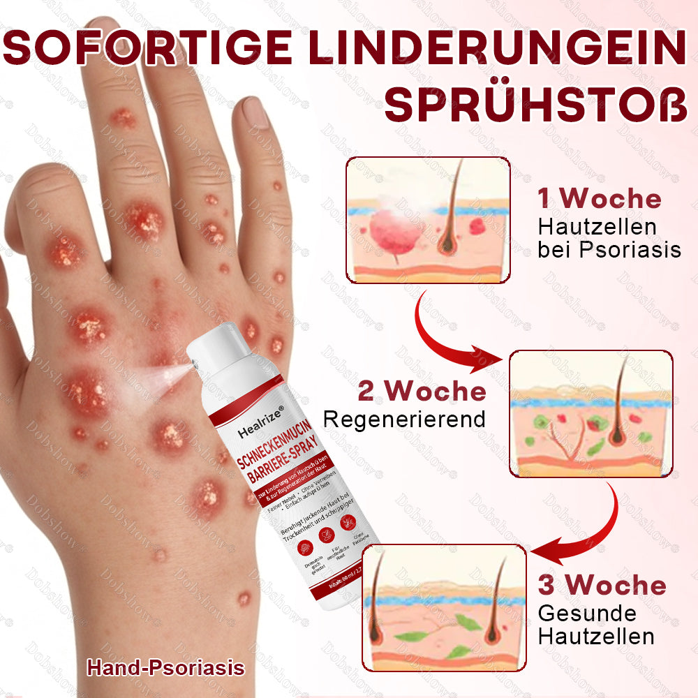 ✅🔥Healrize® Schneckenmucin-Barriere-Spray zur Linderung von Hautschüben und zur Regeneration der Haut