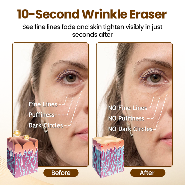 Aureline™ | Renewing 10s Wrinkle Serum – Für Sofort Glatter & Straffer Aussehende Haut