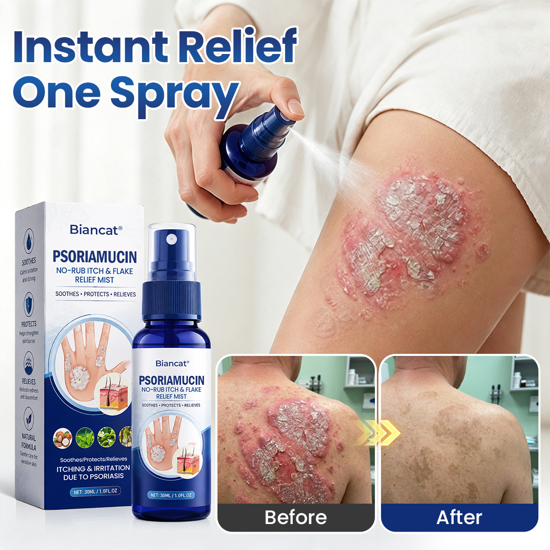 PsoriaVelle™ No-Rub Psoriasis Spray – Gezielte Pflege bei Juckreiz & Schuppen