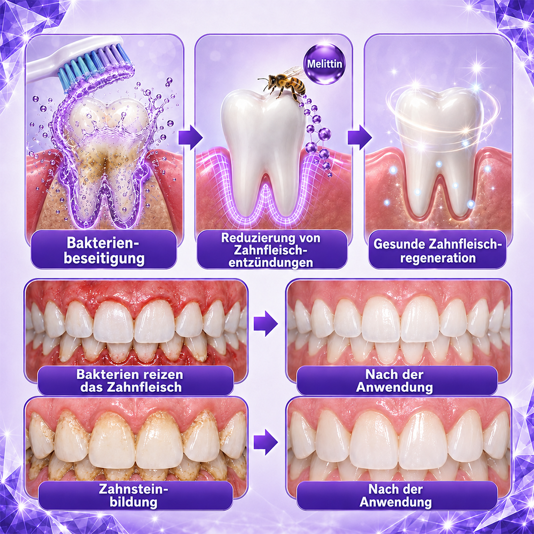 OralVera™ Gingivitis- & Parodontitis-Pflege-Zahnpasta – Zahnfleisch stärken, Zahnfleischbluten reduzieren & Mundgesundheit unterstützen