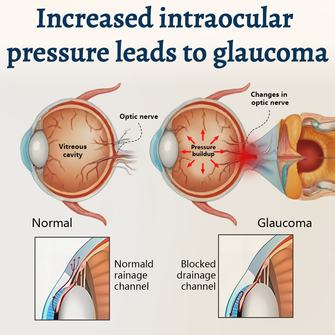 VisionLuma™ Potentes Augenpflaster – Für klare Sicht & entspannte, müde Augen