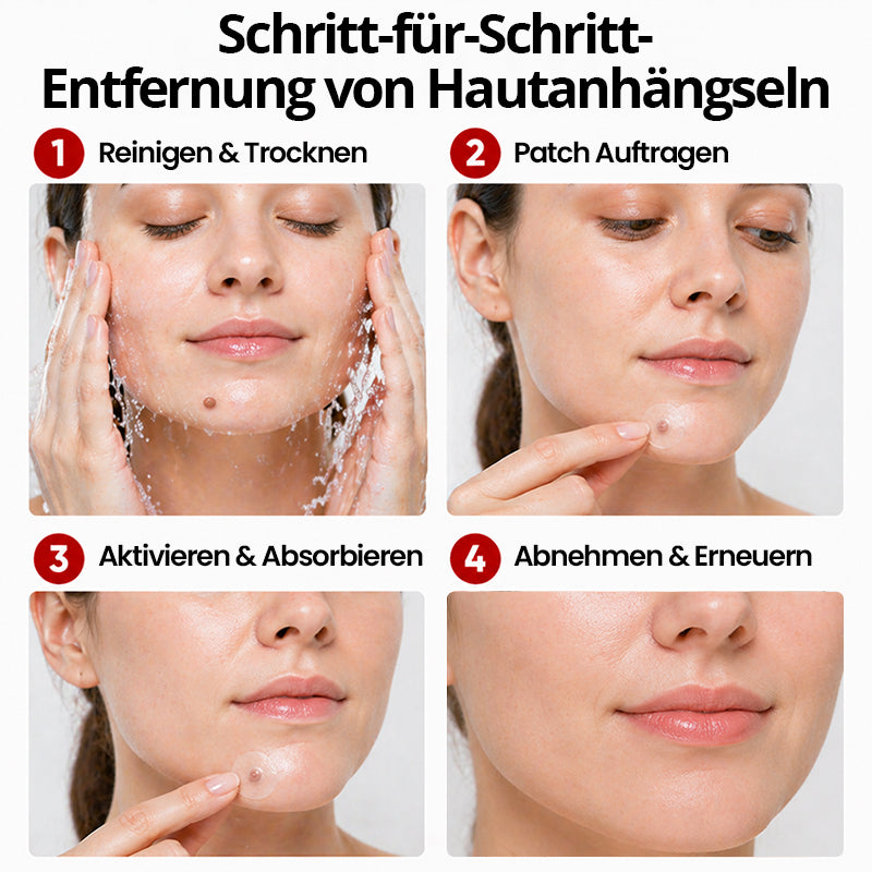 KUBOZN® Hautpflaster zur Skin-Tag-Entfernung  🅱︎