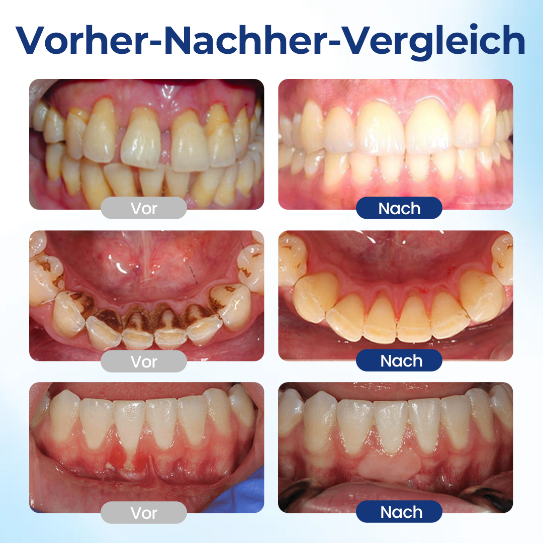 GumVita™ Zahnfleisch-Repair Lösung – Unterstützt gesundes Zahnfleisch & lindert Zahnfleischbeschwerden