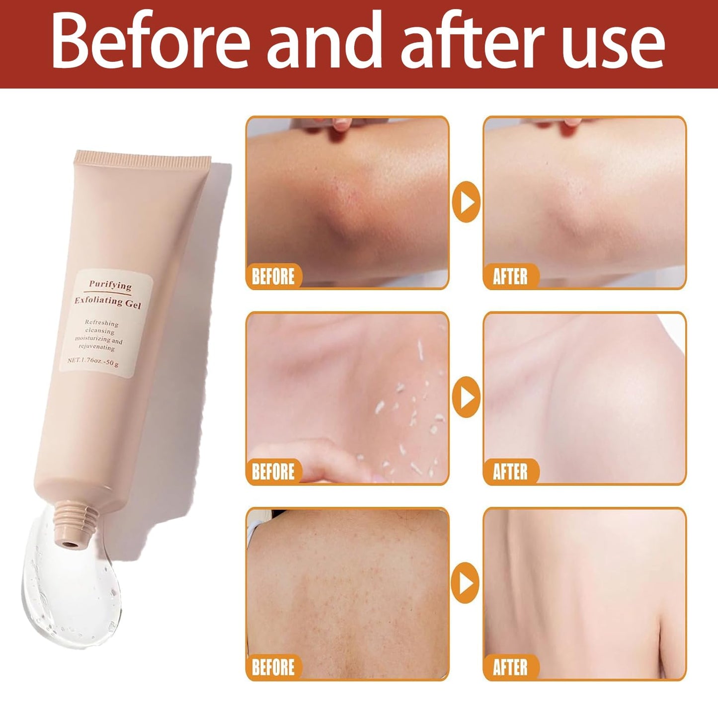1+1 GRATIS | ClearSkin Peeling-Gel – Strahlende Haut in nur 1 Minute