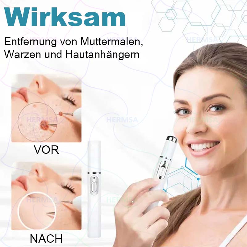 Hermsa® nicht-invasiver Laserpointer - Muttermal- und Warzenentfernung