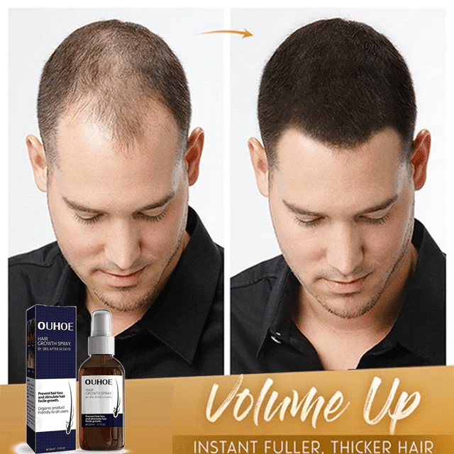 RootRevive™ Natürliches Haarpflege-Spray – Für Voller & Kräftiger Aussehendes Haar