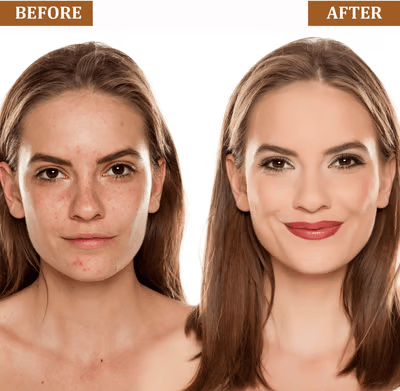 1+1 GRATIS | ElaraGlow™ | Perfekte Haut, die sich den ganzen Tag wie Magie anfühlt