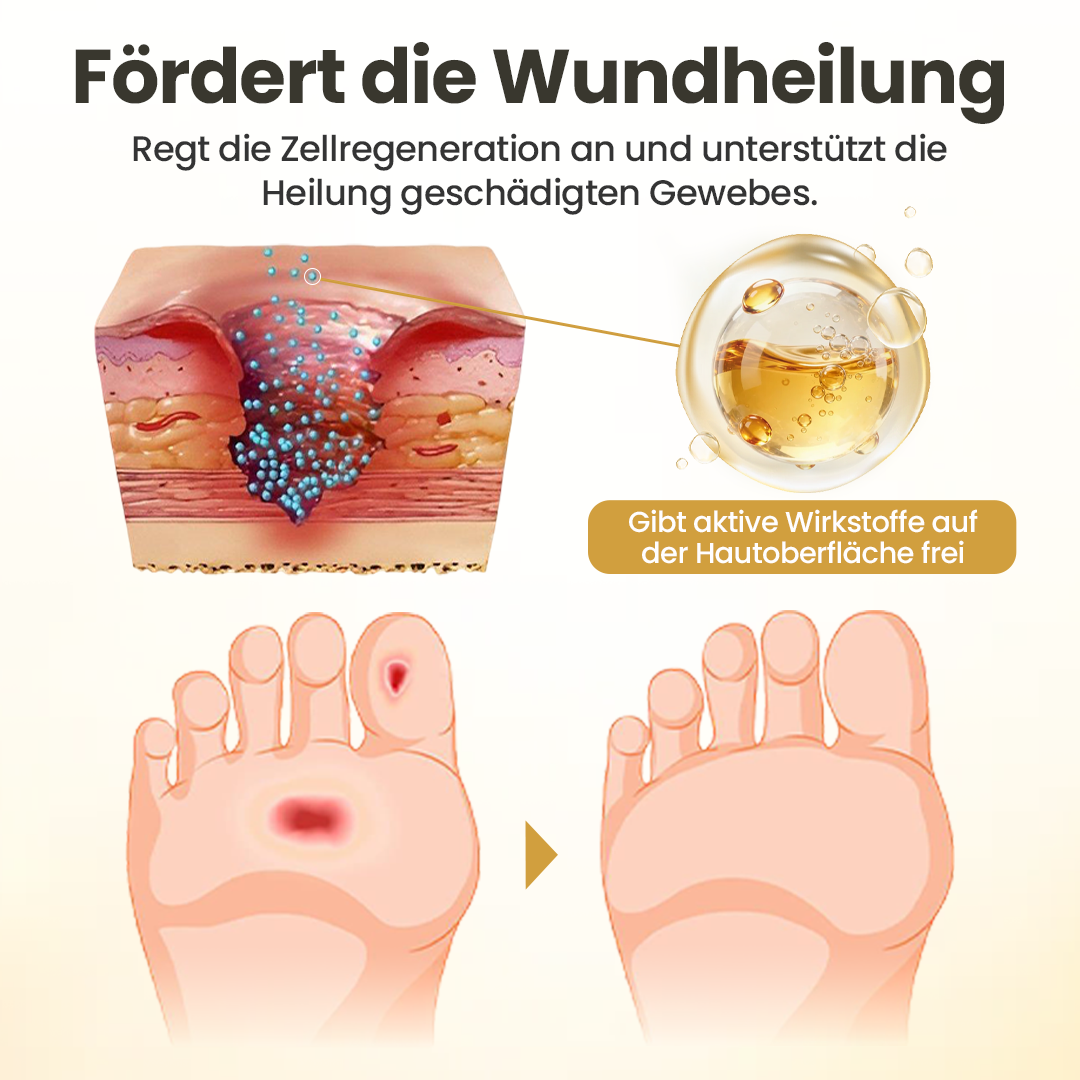 GlucoSentry™ 24H Fuß-Barriere-Spray – Diabetische Fußhaut schützen, Wundpflege unterstützen & Reizungen reduzieren