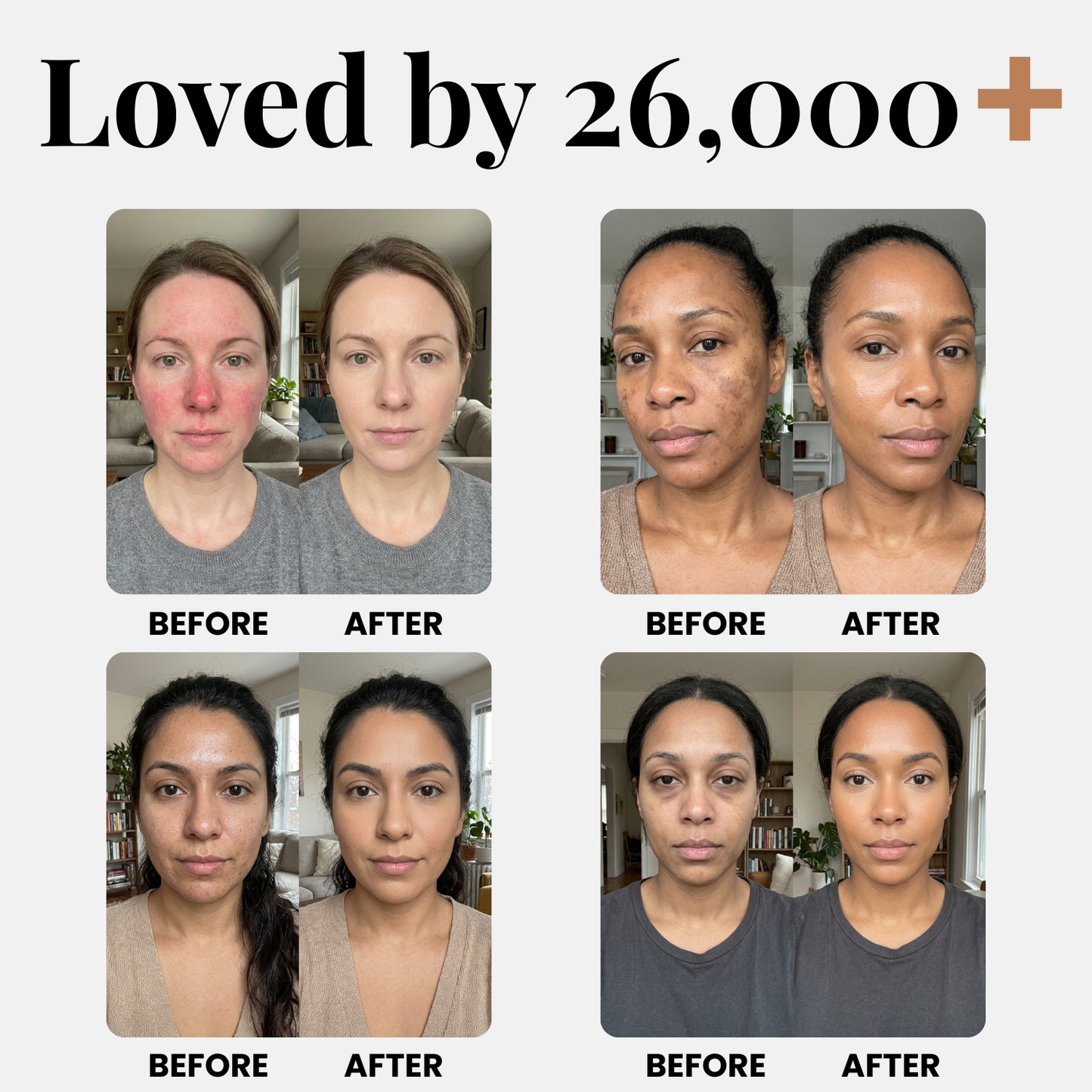 SkinVeil™ Hautperfektionierender Balm – Kaschiert Rötungen, Poren & Unreinheiten für einen ebenmäßigen Teint