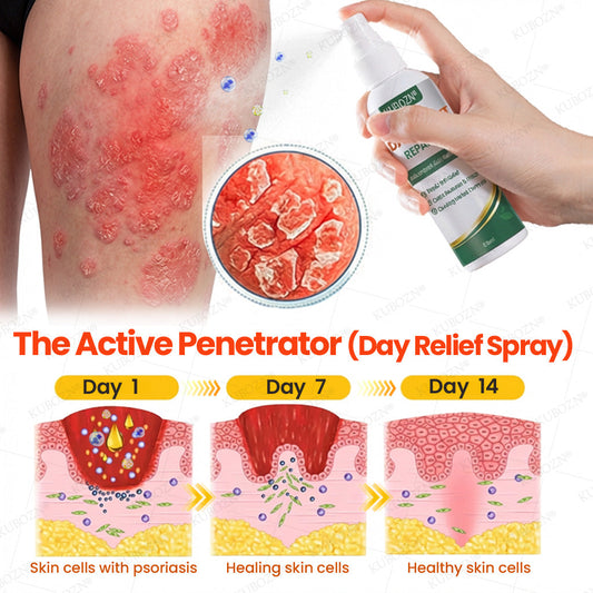 Psoriasis Tag- & Nacht-Reparatursystem | 24h Hautpflege-Duo