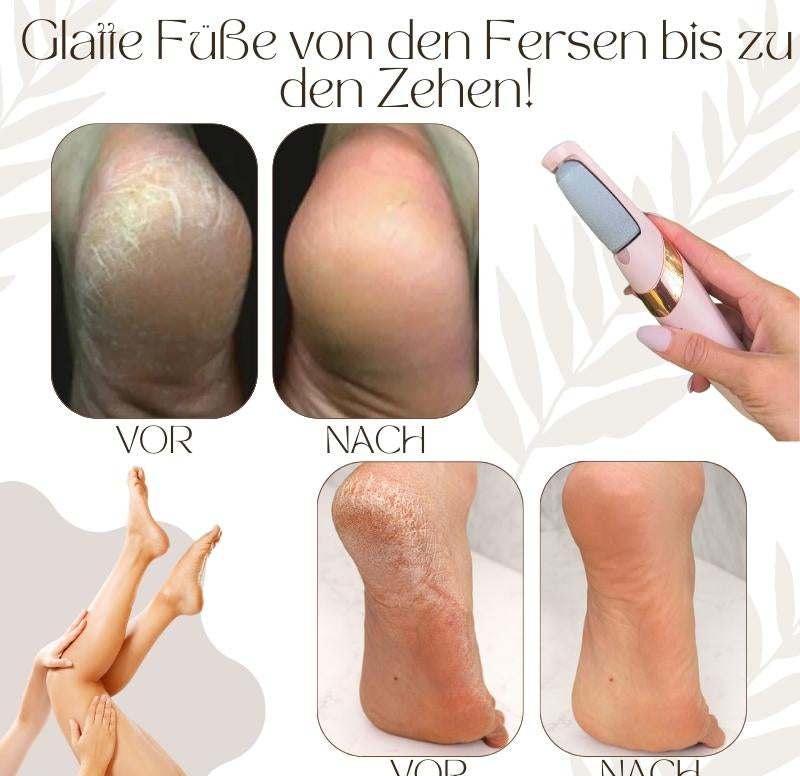 CallusMaster™ – Elektrischer Hornhautentferner