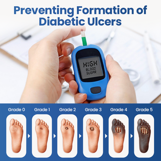 DermaShield™ Barrierespray für Diabetische Fußpflege