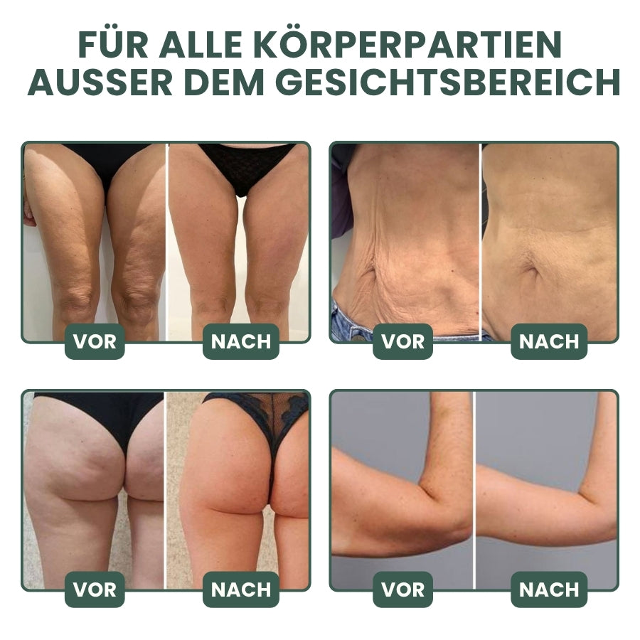 DermaLisse™ Kollagen-Lifting Körperöl – Für Glatter & Straffer Aussehende Haut