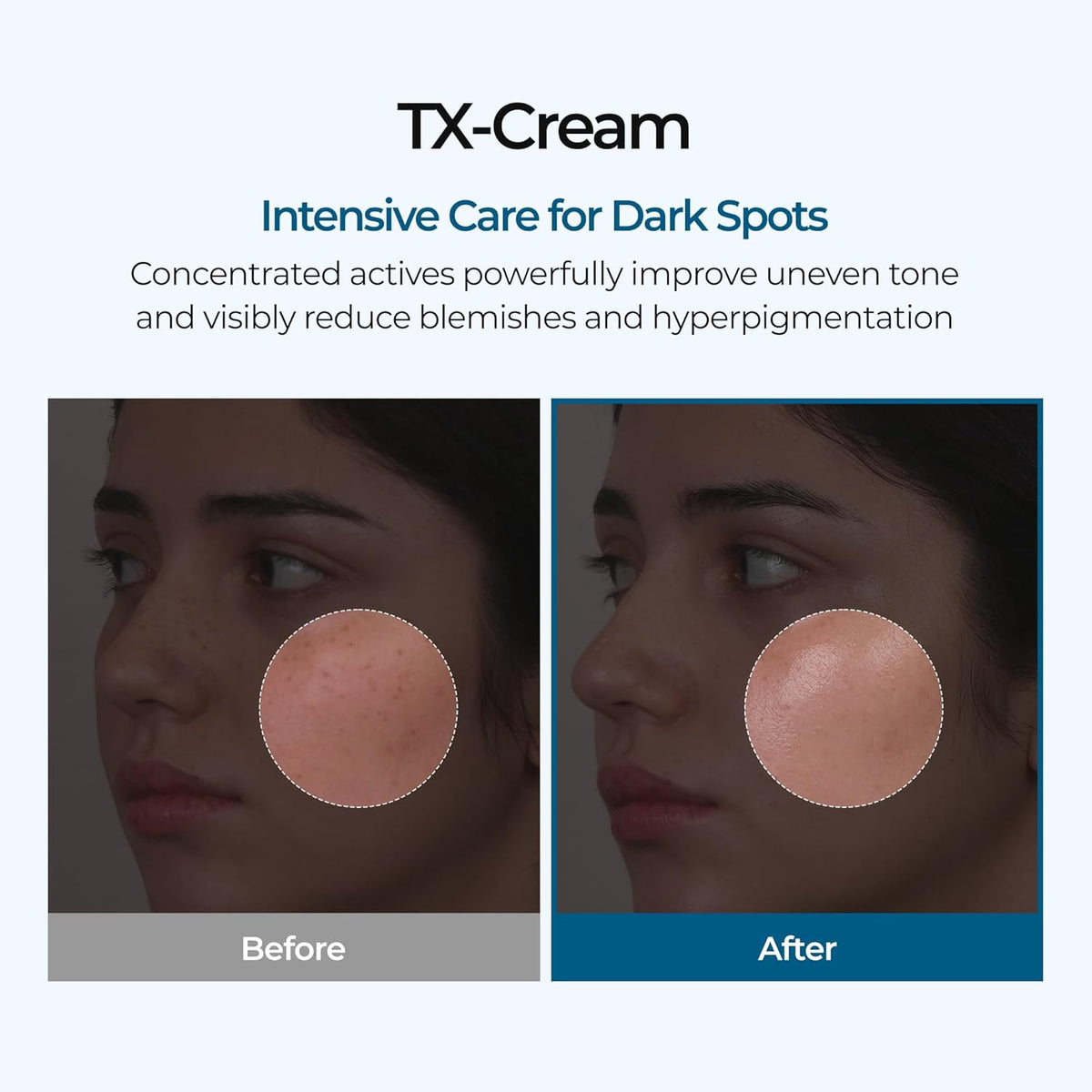 Tonevia™ Koreanische Tranexamsäure-Creme – Für einen strahlenderen, ebenmäßigeren Teint
