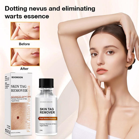 Hautanhängsel Entferner - Natürliche Formel mit Jojobaöl & Vitamin E