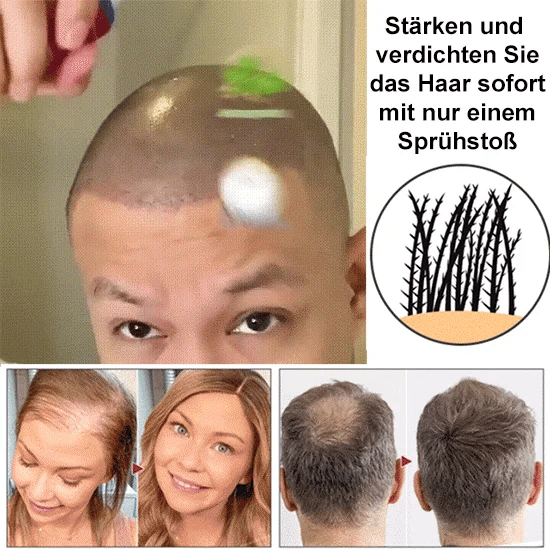 RootRevive™ Natürliches Haarpflege-Spray – Für Voller & Kräftiger Aussehendes Haar