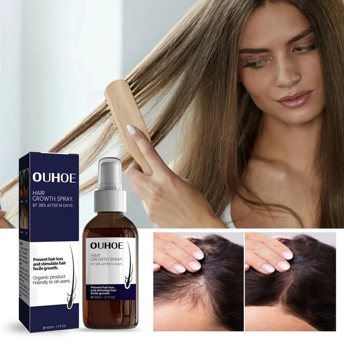 RootRevive™ Natürliches Haarpflege-Spray – Für Voller & Kräftiger Aussehendes Haar