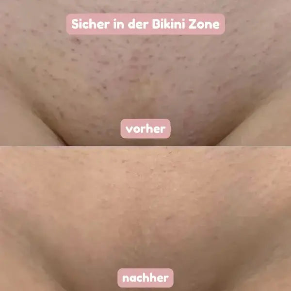 SeidenGlanz™ | 2 in 1 Damenrasierer für glatte und gepflegte Haut