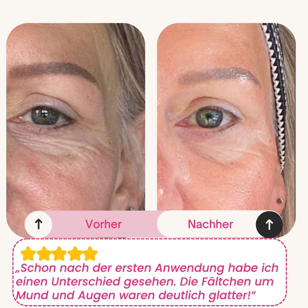 Skinly - Bio-Kollagen Maske (5 Masken)