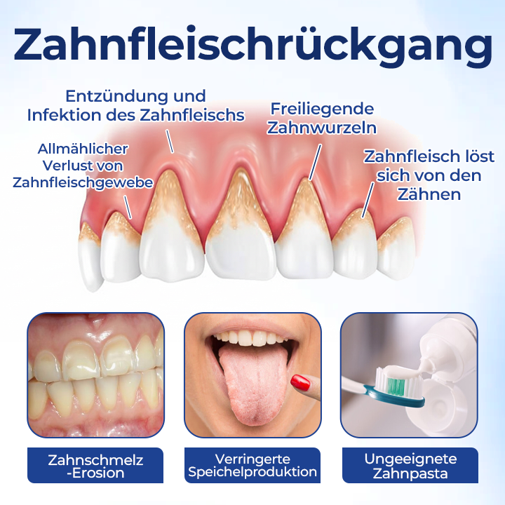 GumVita™ Zahnfleisch-Repair Lösung – Unterstützt gesundes Zahnfleisch & lindert Zahnfleischbeschwerden
