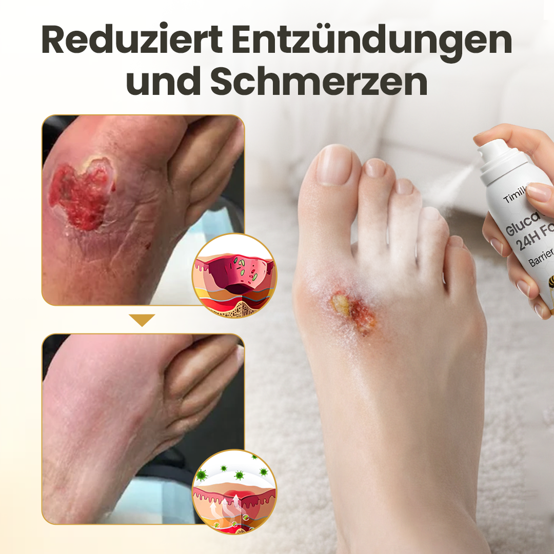 GlucoSentry™ 24H Fuß-Barriere-Spray – Diabetische Fußhaut schützen, Wundpflege unterstützen & Reizungen reduzieren