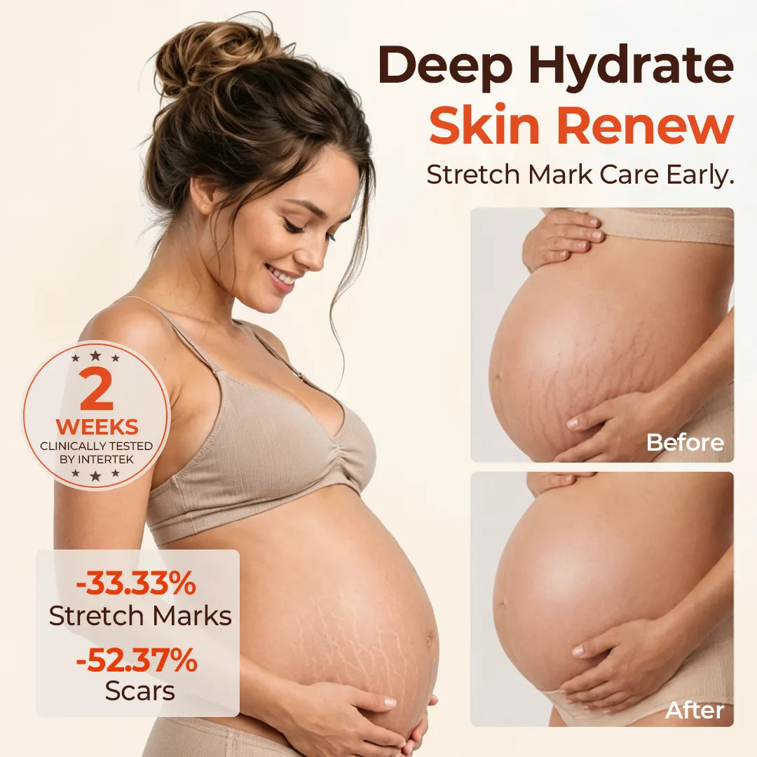 DermaSilk™ Stretch Mark & Scar Oil – Natürlich pflegen, glätten & das Erscheinungsbild von Dehnungsstreifen reduzieren