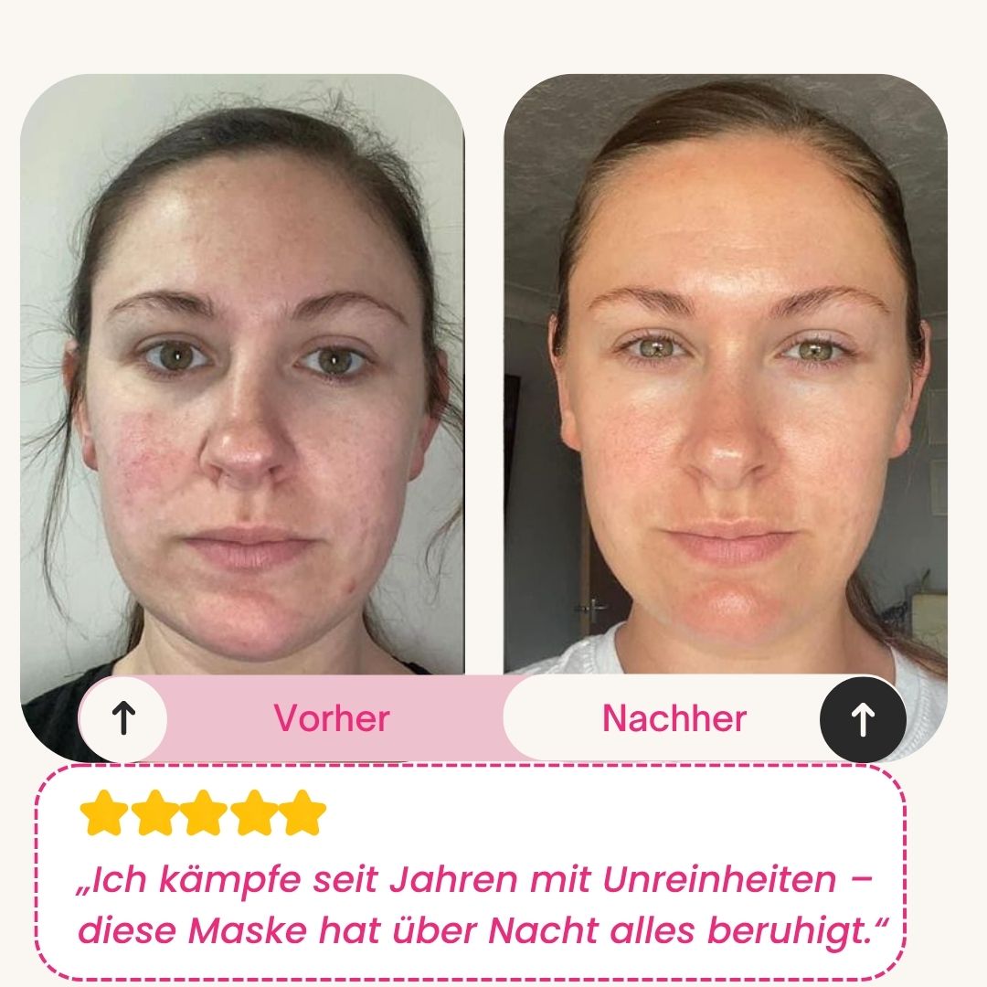 Skinly - Bio-Kollagen Maske (5 Masken)