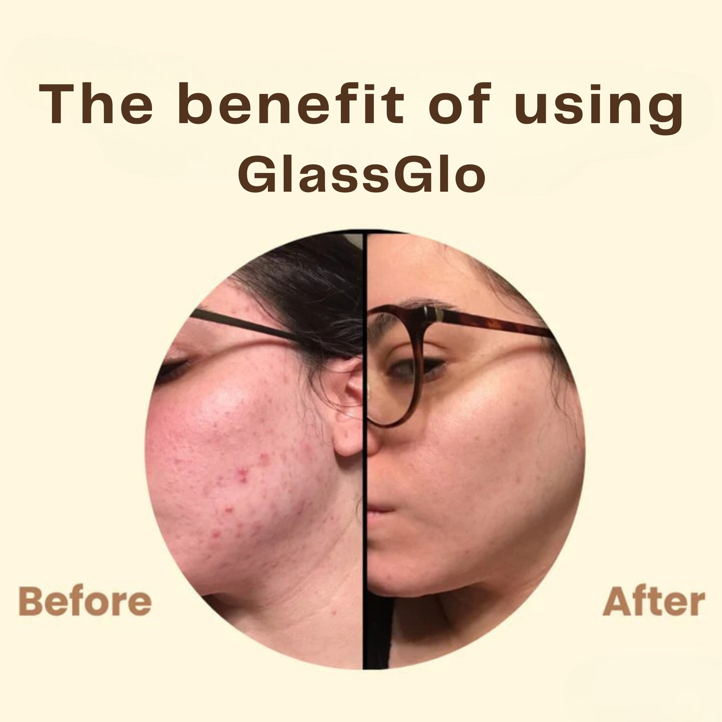 GlassGlo™ - Tiefenreinigende Peel-Off-Maske
