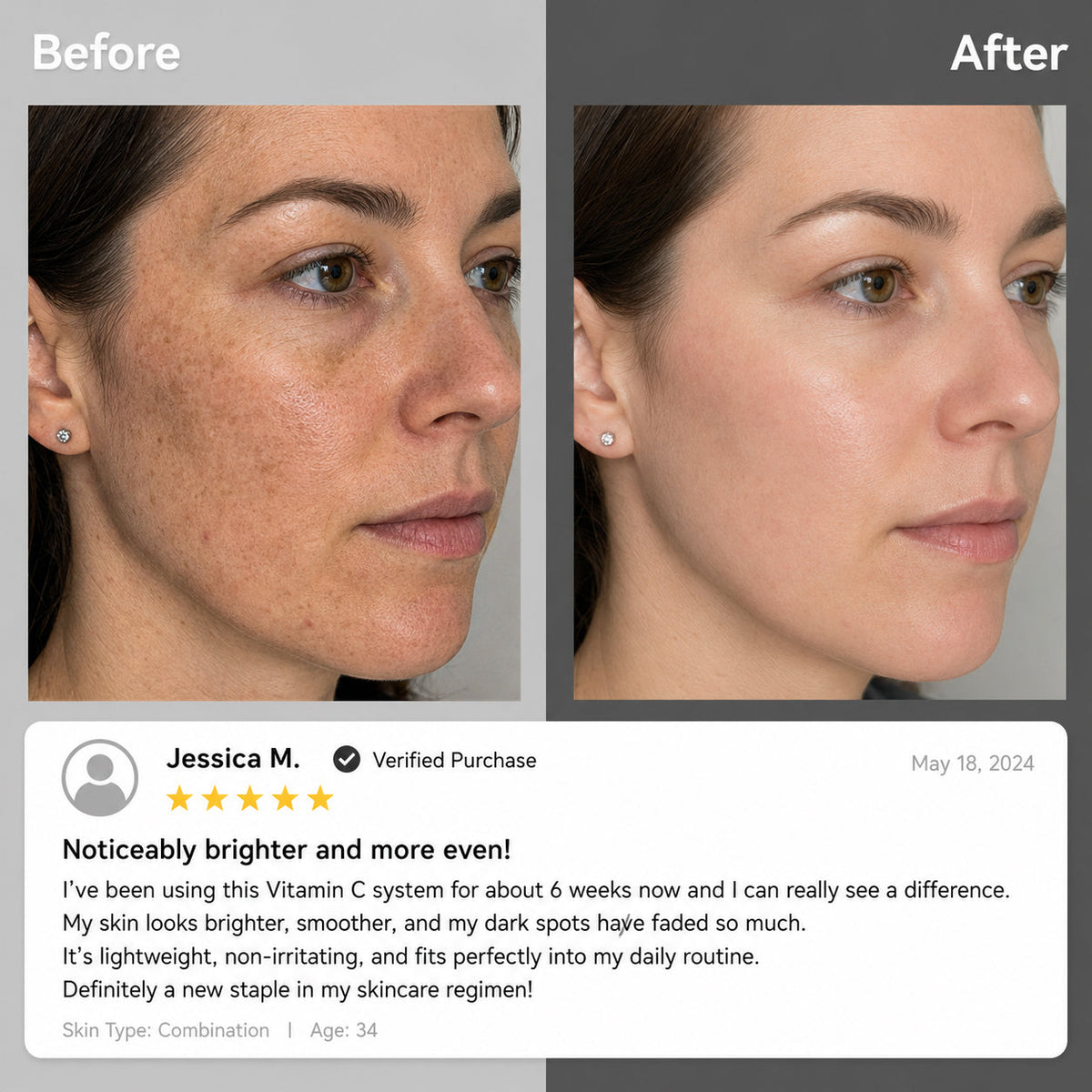 CielaDuo™ Vitamin-C-Duo-Creme – Tages- & Nachtpflege für strahlendere, ebenmäßigere Haut