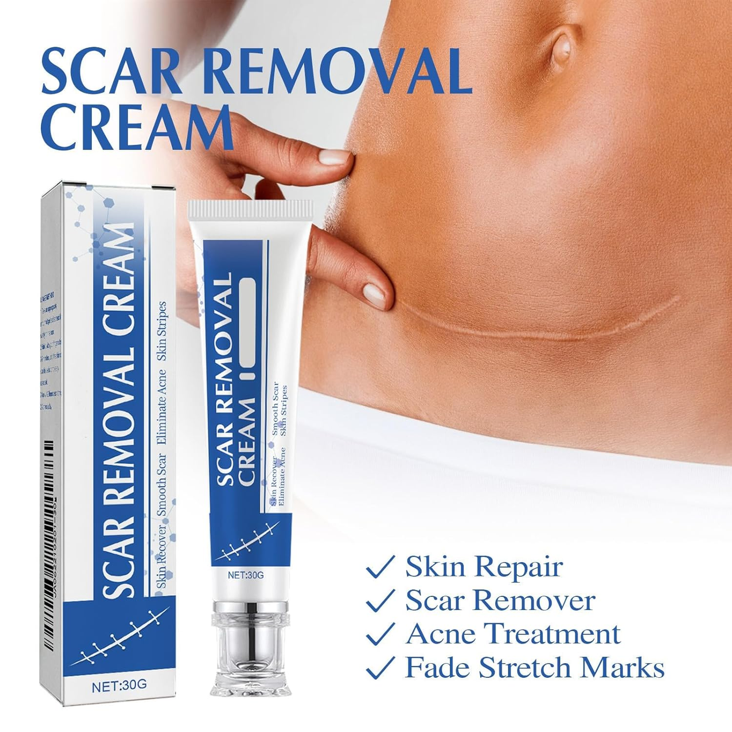 🔥 Letzter Tag: 50 % RABATT – 🩹 Alcuras® Medizinische Silikon-Narbencreme – Sichtbar glattere Haut ab der ersten Anwendung!