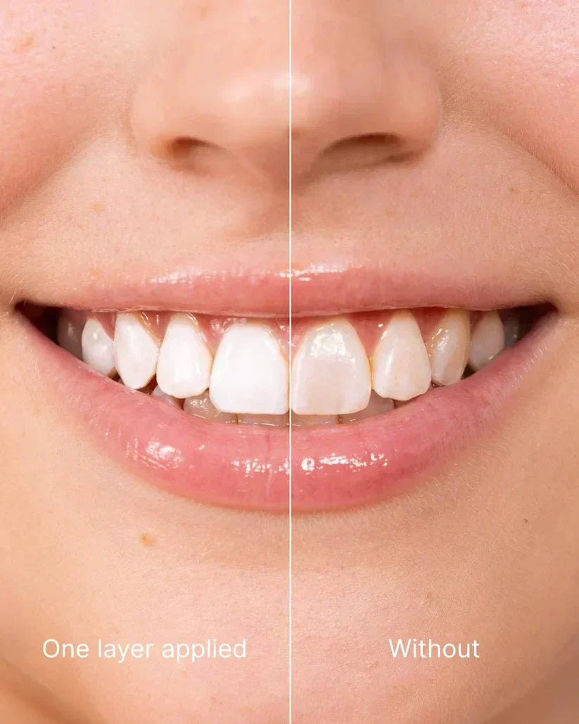 SmileLuxe™ Zahn-Polish – Sofort Strahlenderes Lächeln in Sekunden