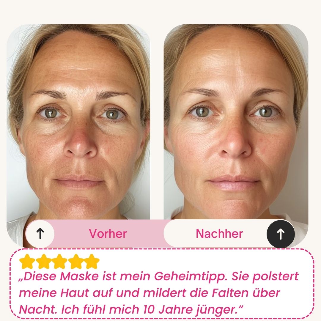 Skinly - Bio-Kollagen Maske (5 Masken)