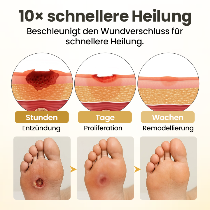 GlucoSentry™ 24H Fuß-Barriere-Spray – Diabetische Fußhaut schützen, Wundpflege unterstützen & Reizungen reduzieren