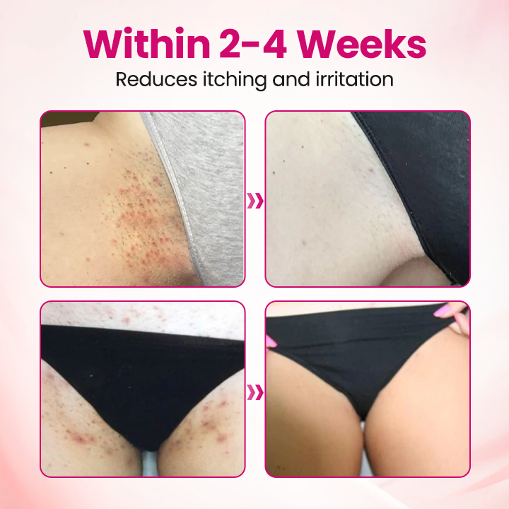 ViraCera™ IntiDefend Anti-HPV Interferon-Gel – Unterstützt HPV-Abwehr, Schleimhautheilung & Intimgesundheit