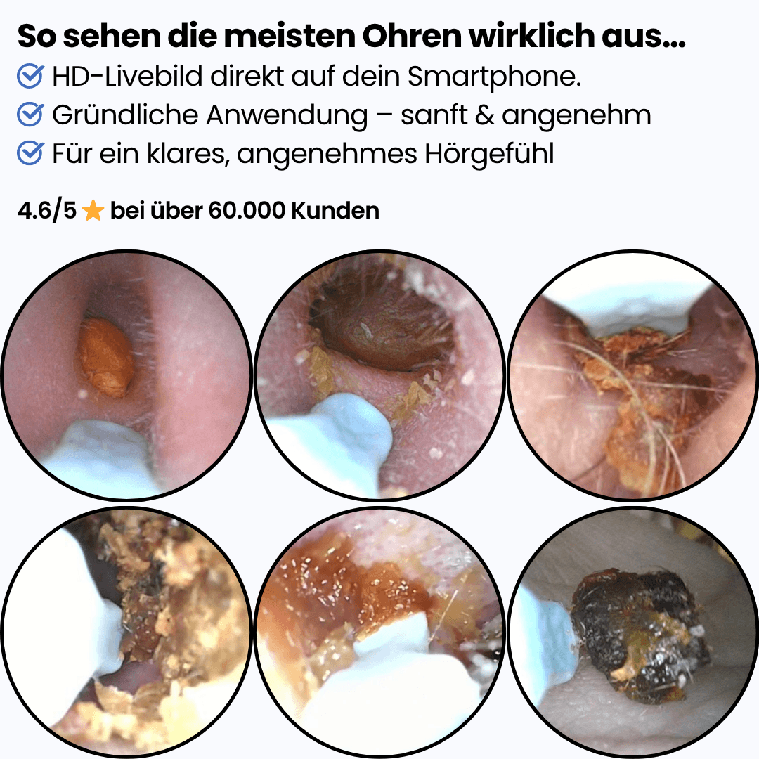 Miluna™ Intelligenter visueller Ohrreiniger