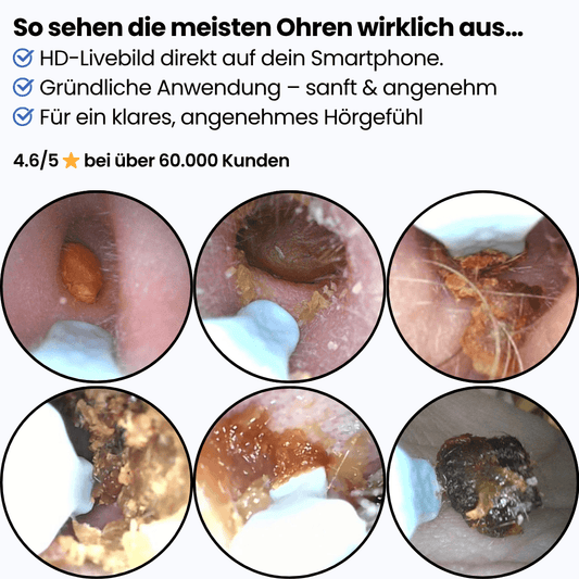 Miluna™ Intelligenter visueller Ohrreiniger