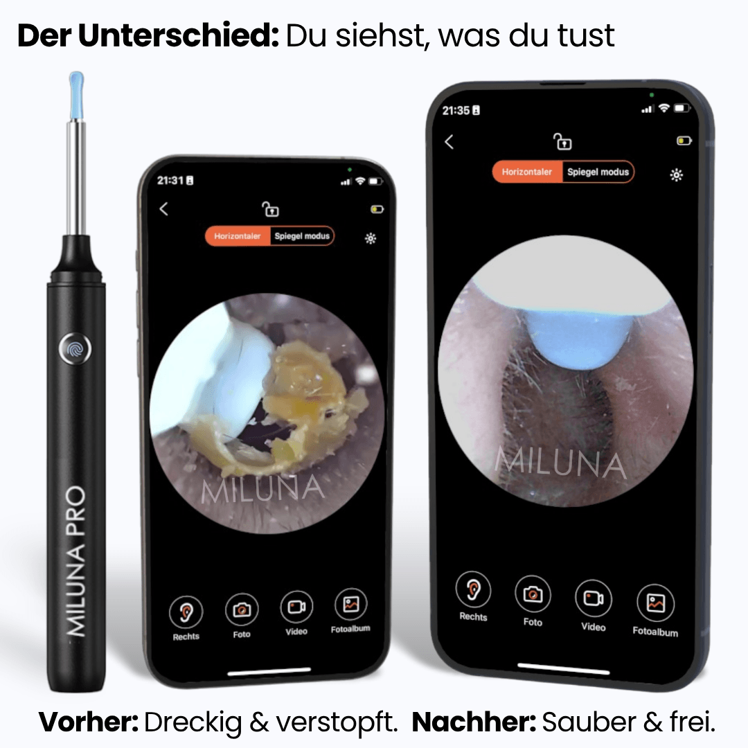 Miluna™ Intelligenter visueller Ohrreiniger
