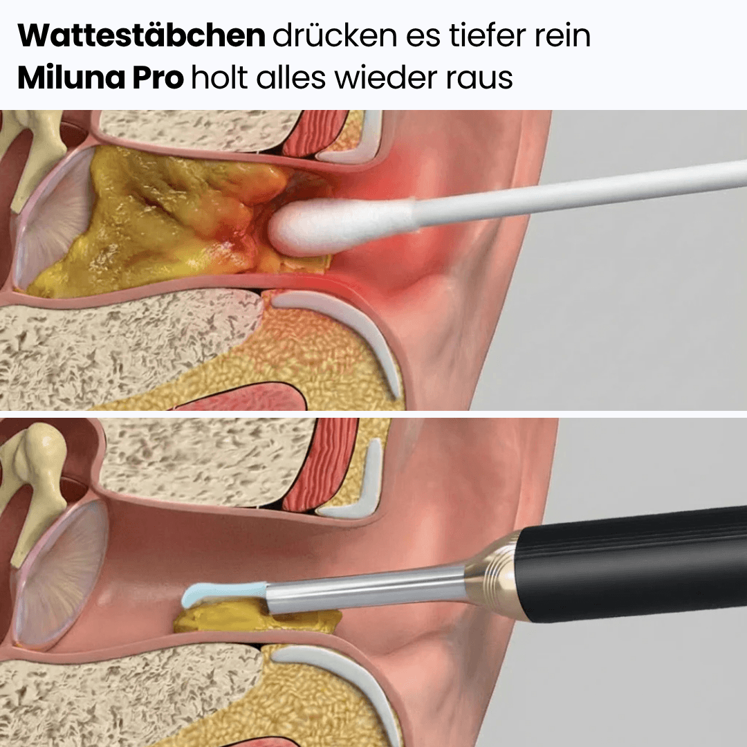 Miluna™ Intelligenter visueller Ohrreiniger