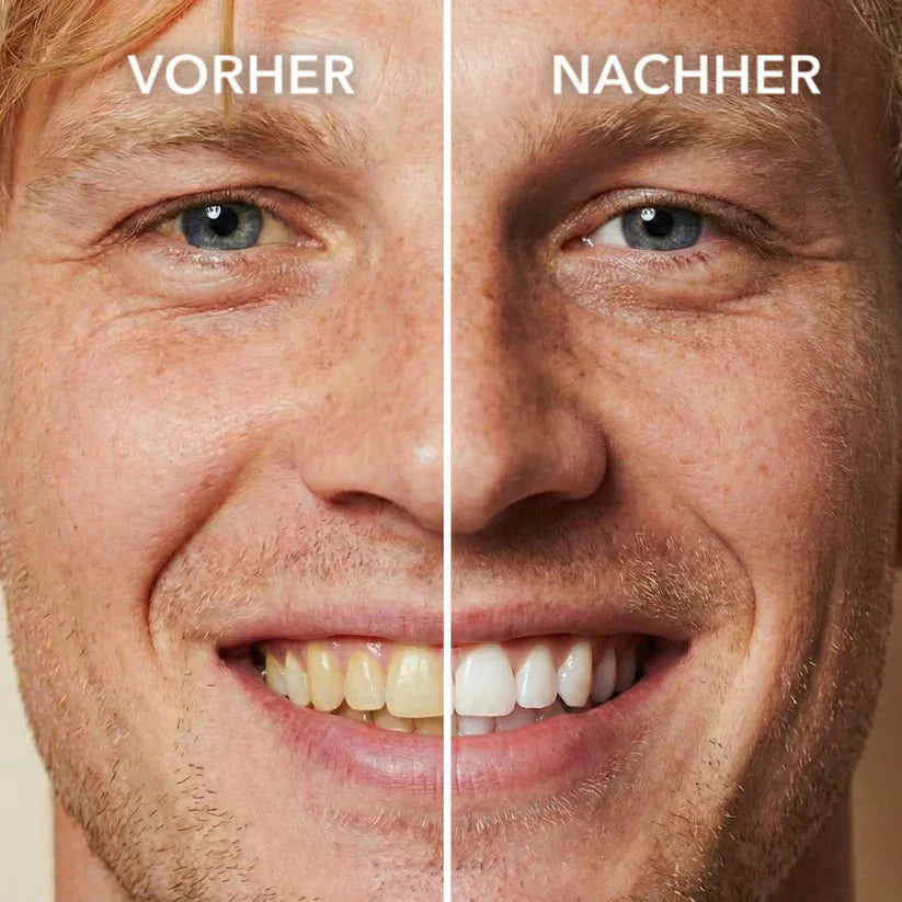 SmileLuxe™ Zahn-Polish – Sofort Strahlenderes Lächeln in Sekunden