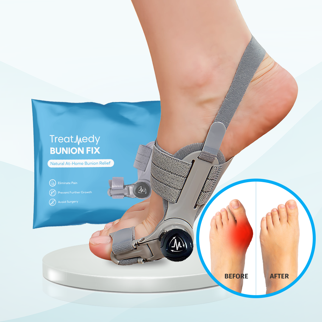 AlignStep™ Hallux-Valgus Korrektor – Für Mehr Komfort Bei Jedem Schritt