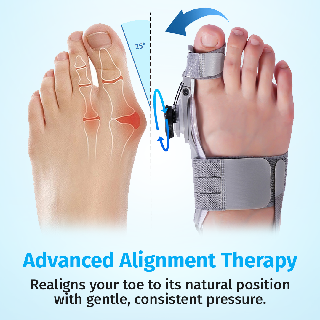 AlignStep™ Hallux-Valgus Korrektor – Für Mehr Komfort Bei Jedem Schritt