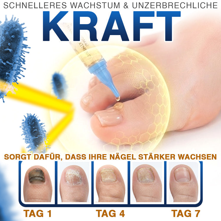 MycoVera™ FungiFree Bienengift-Nagelbehandlung – gegen hartnäckigen Nagelpilz & für gesünderes Nagelwachstum