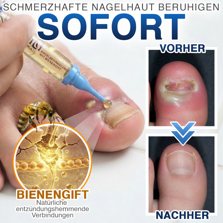 MycoVera™ FungiFree Bienengift-Nagelbehandlung – gegen hartnäckigen Nagelpilz & für gesünderes Nagelwachstum