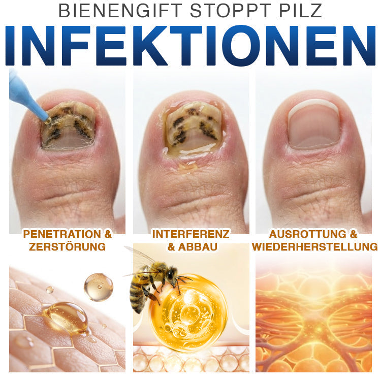 MycoVera™ FungiFree Bienengift-Nagelbehandlung – gegen hartnäckigen Nagelpilz & für gesünderes Nagelwachstum