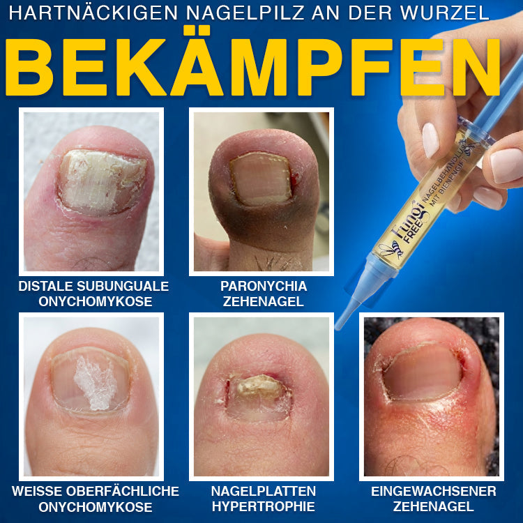 MycoVera™ FungiFree Bienengift-Nagelbehandlung – gegen hartnäckigen Nagelpilz & für gesünderes Nagelwachstum