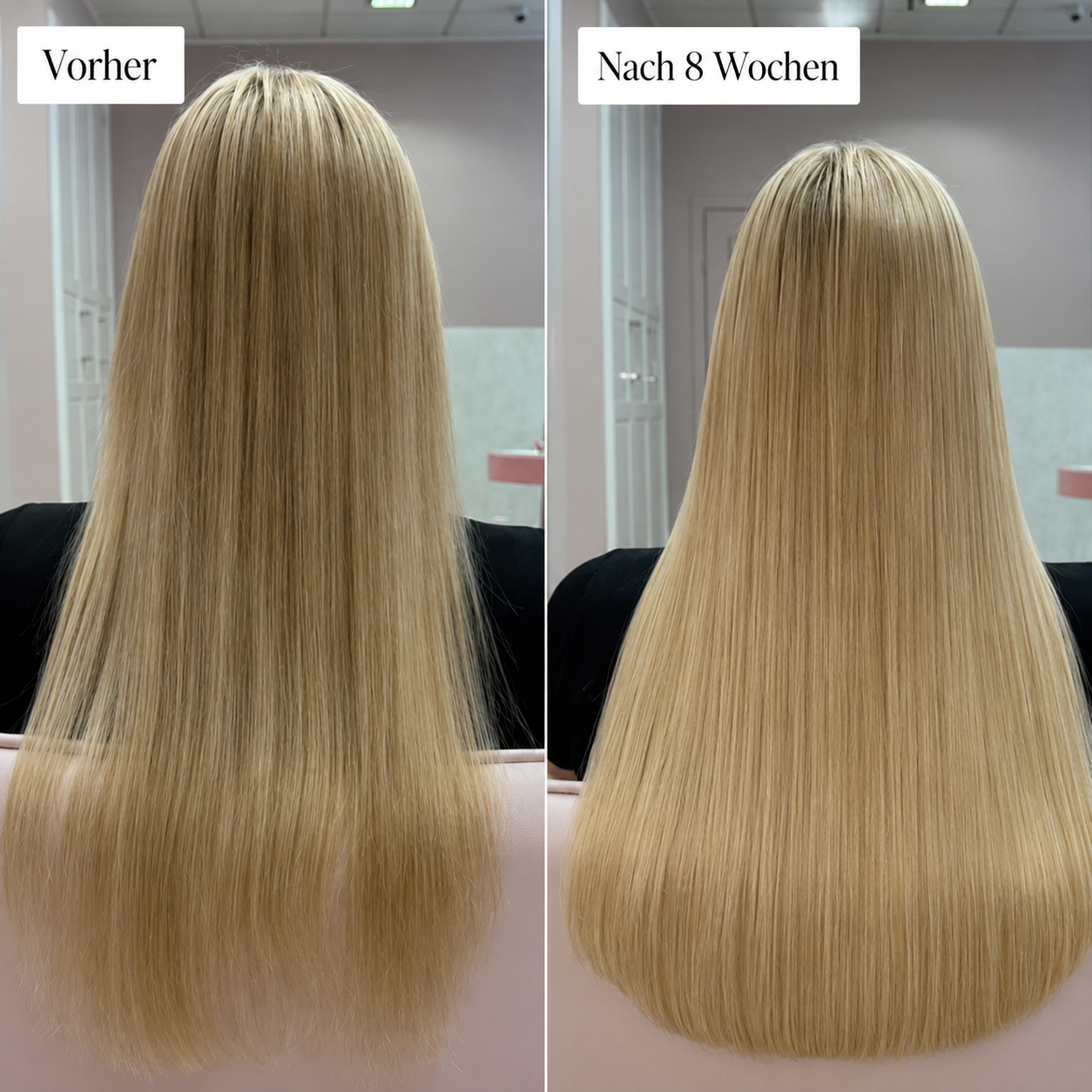 Avellio™ Haarwuchs System